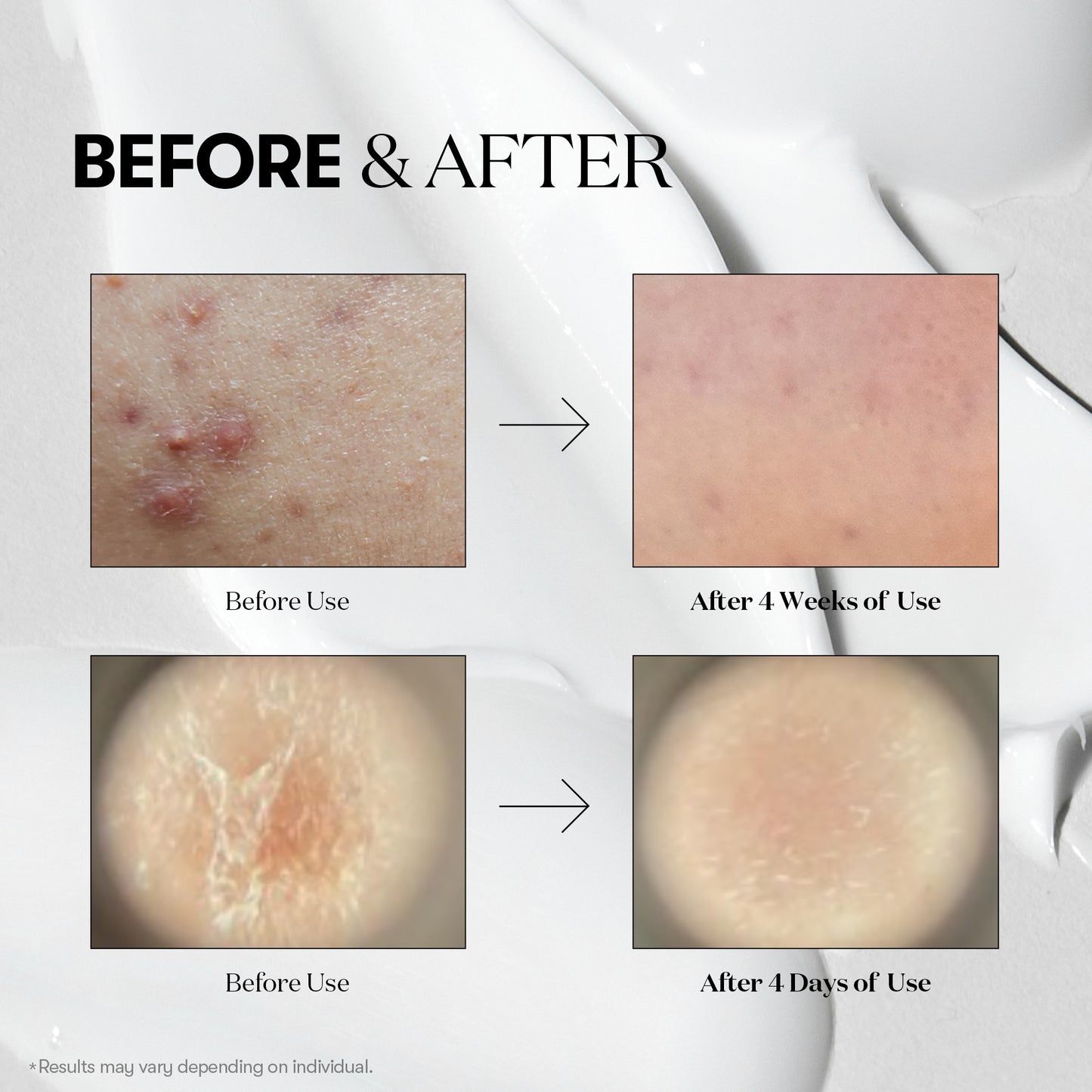 [VT COSMETIC] Reedle Shot 100 I 50ml